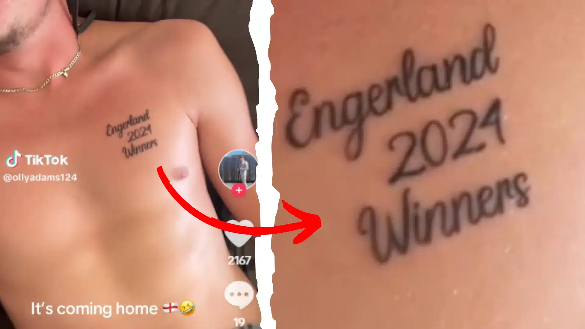 England Tattoo Fail: Jack und sein peinliches "Engerland"-Tattoo nach der EM-Niederlage